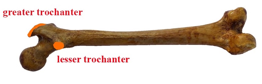 greater and lesser trochanter of femur